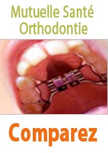 comparateur mutuelles santé orthodontie pas chères